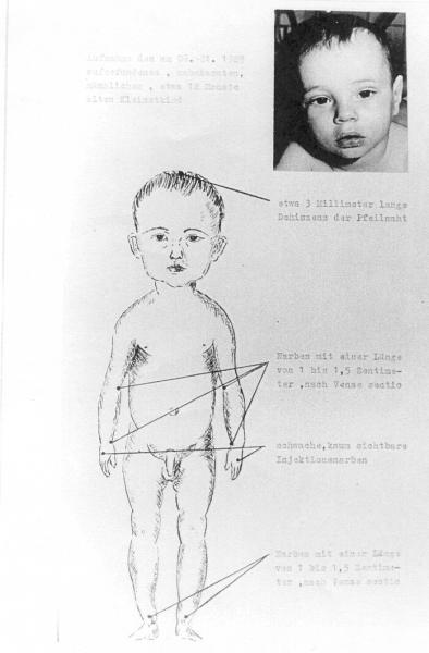 Gesundheitsbericht Findelkind 08.01.1985